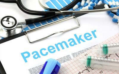 The Risk of EMI and Your Pacemaker